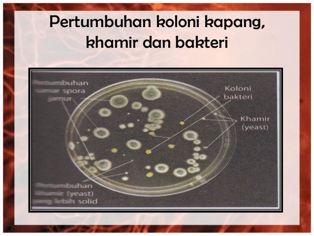 Morfologi bakteri, kapang dan khamir