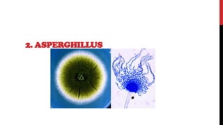 2. ASPERGHILLUS
 