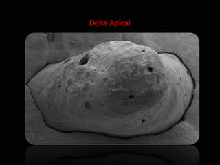 Morfologia y anatomía radicular Endodoncia | PPTX