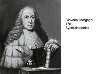 Giovanni Morgagni 
1761 
Syphilitic aortitis 
 