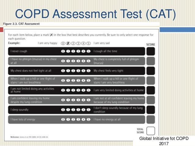 COPD and Key Indicators For Considering Diagnosis