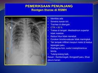 Hasil Rontgen Thorax morning report EKG 1.pptx