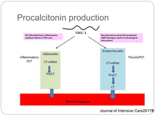 Procalcitonin production
Journal of Intensive Care20175:5
 
