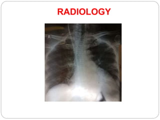 RADIOLOGY
 