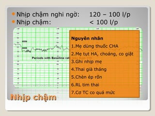 Nhịp chậm nghi ngờ: 120 – 100 l/p 
Nhịp chậm: < 100 l/p 
NNhhịịpp cchhậậmm 
Nguyên nhân 
1.Mẹ dùng thuốc CHA 
2.Mẹ tụt HA, choáng, co giật 
3.Ghi nhịp mẹ 
4.Thai già tháng 
5.Chèn ép rốn 
6.RL tim thai 
7.Cơ TC co quá mức 
 