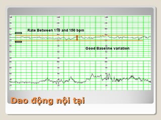 DDaaoo đđộộnngg nnộộii ttạạii 
 
