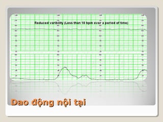 DDaaoo đđộộnngg nnộộii ttạạii 
 