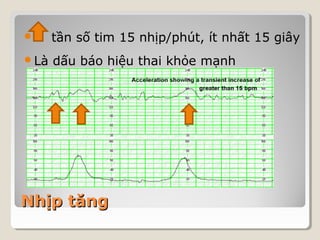  tần số tim 15 nhịp/phút, ít nhất 15 giây 
Là dấu báo hiệu thai khỏe mạnh 
NNhhịịpp ttăănngg 
 