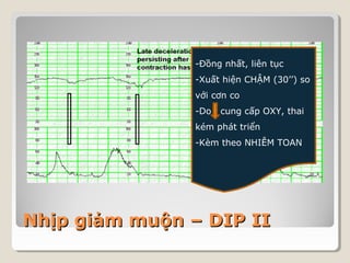 -Đồng nhất, liên tục 
-Xuất hiện CHẬM (30’’) so 
với cơn co 
-Do cung cấp OXY, thai 
kém phát triển 
-Kèm theo NHIỄM TOAN 
NNhhịịpp ggiiảảmm mmuuộộnn –– DDIIPP IIII 
 