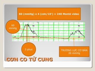 60 (mmHg) x 4 (cơn/10’) = 240 Monté video 
CCƠƠNN CCOO TTỬỬ CCUUNNGG 
TRƯƠNG LỰC CƠ BẢN 
20 mmHg 
60 
mmHg 
3 phut 
 