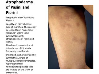 Morphea | PPTX