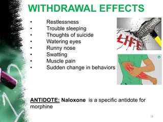 WITHDRAWAL EFFECTS
• Restlessness
• Trouble sleeping
• Thoughts of suicide
• Watering eyes
• Runny nose
• Swatting
• Muscle pain
• Sudden change in behaviors
ANTIDOTE: Naloxone is a specific antidote for
morphine
28
 