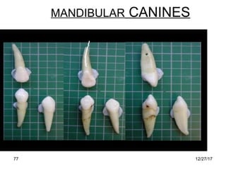 12/27/1777
MANDIBULAR CANINES
 