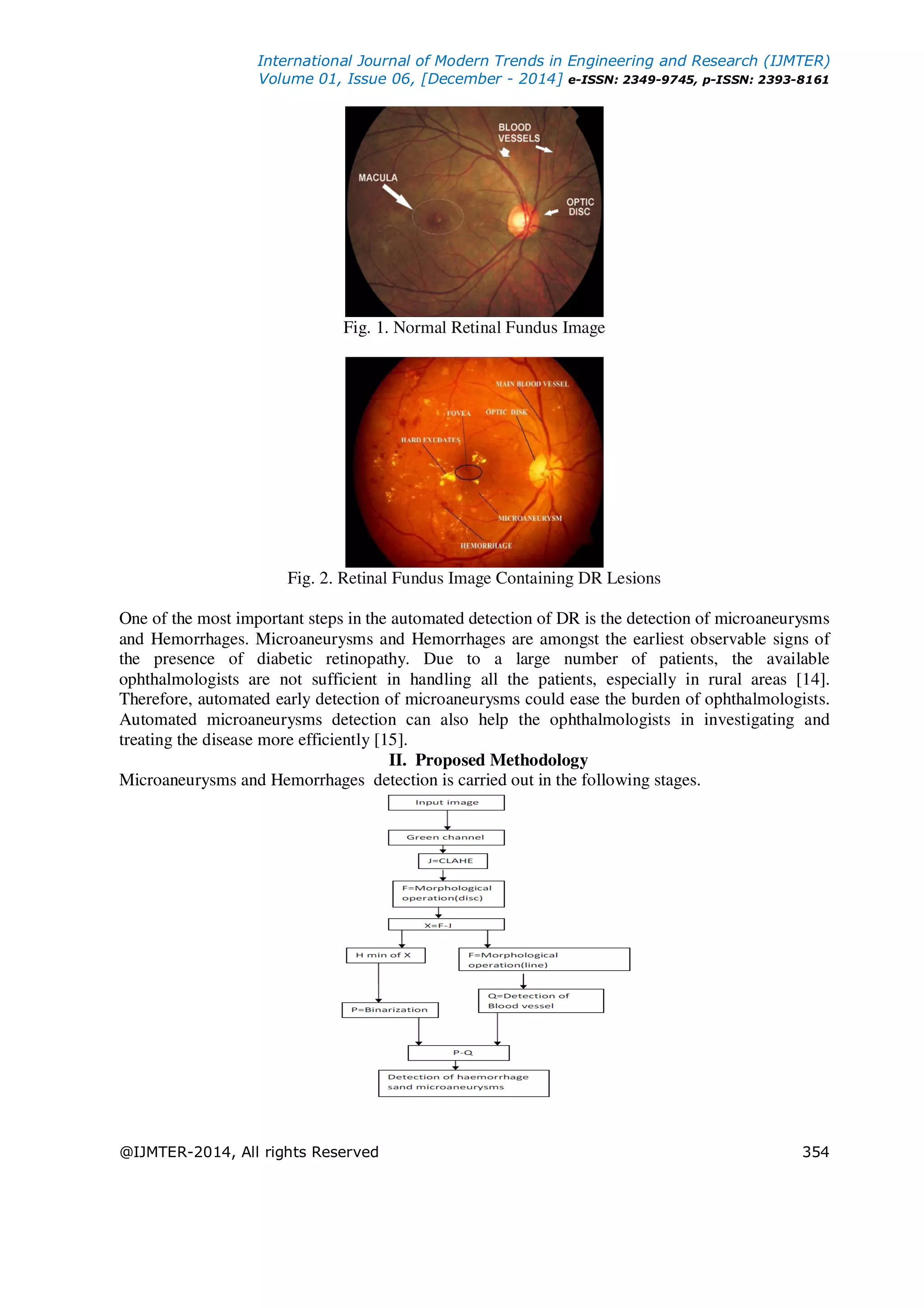 International Journal of Modern Trends in Engineering and Research (IJMTER)
Volume 01, Issue 06, [December - 2014] e-ISSN: 2349-9745, p-ISSN: 2393-8161
@IJMTER-2014, All rights Reserved 354
Fig. 1. Normal Retinal Fundus Image
Fig. 2. Retinal Fundus Image Containing DR Lesions
One of the most important steps in the automated detection of DR is the detection of microaneurysms
and Hemorrhages. Microaneurysms and Hemorrhages are amongst the earliest observable signs of
the presence of diabetic retinopathy. Due to a large number of patients, the available
ophthalmologists are not sufficient in handling all the patients, especially in rural areas [14].
Therefore, automated early detection of microaneurysms could ease the burden of ophthalmologists.
Automated microaneurysms detection can also help the ophthalmologists in investigating and
treating the disease more efficiently [15].
II. Proposed Methodology
Microaneurysms and Hemorrhages detection is carried out in the following stages.
 