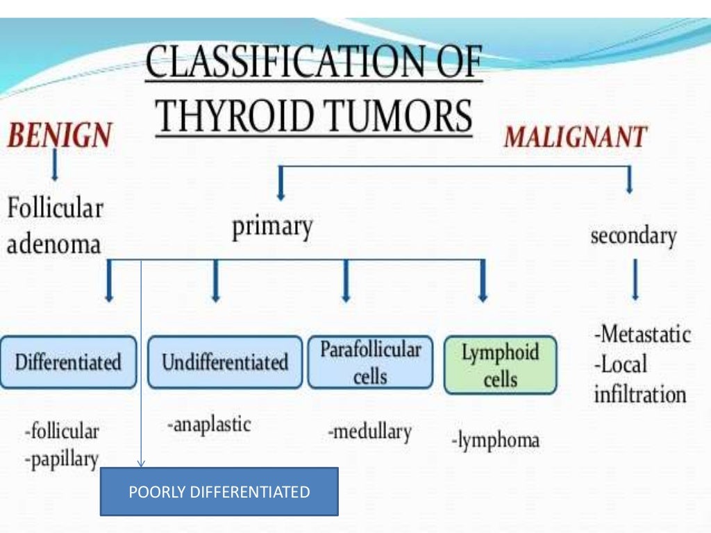Morphological spectrum of malignant thyroid neoplasm