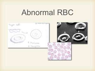 Blood smear morphology | PPTX