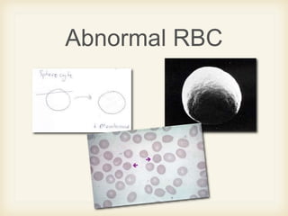 Spikey Rbc Blood smear morphology | PPTX