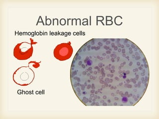 Blood smear morphology | PPTX