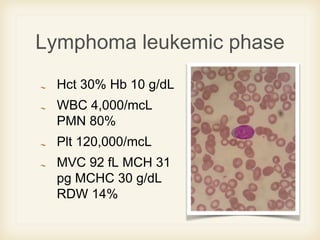Lymphoma leukemic phase
Hct 30% Hb 10 g/dL
WBC 4,000/mcL
PMN 80%
Plt 120,000/mcL
MVC 92 fL MCH 31
pg MCHC 30 g/dL
RDW 14%
 