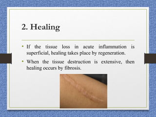 2. Healing
• If the tissue loss in acute inflammation is
superficial, healing takes place by regeneration.
• When the tissue destruction is extensive, then
healing occurs by fibrosis.
 