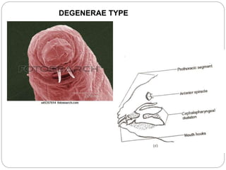 DEGENERAE TYPE
 