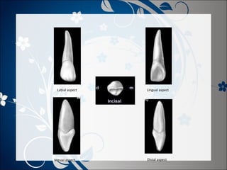 Labial aspect

Mesial aspect

Lingual aspect

Distal aspect

 
