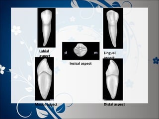 Labial
aspect

Lingual
aspect
Incisal aspect

Mesial aspect

Distal aspect

 