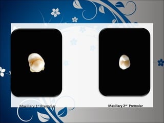 Maxillary 1st Premolar

Maxillary 2nd Premolar

 