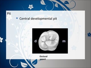 Pit


Central developmental pit

Occlusal
aspect

 