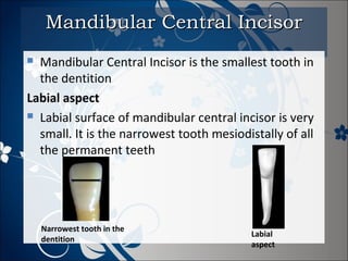 Mandibular Central Incisor
Mandibular Central Incisor is the smallest tooth in
the dentition
Labial aspect
 Labial surface of mandibular central incisor is very
small. It is the narrowest tooth mesiodistally of all
the permanent teeth


Narrowest tooth in the
dentition

Labial
aspect

 