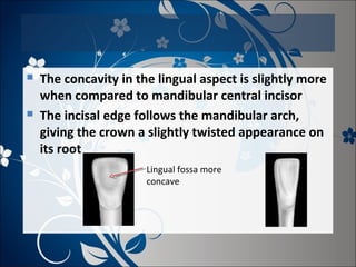 



The concavity in the lingual aspect is slightly more
when compared to mandibular central incisor
The incisal edge follows the mandibular arch,
giving the crown a slightly twisted appearance on
its root
Lingual fossa more
concave

 