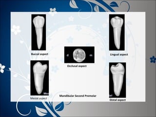 Buccal aspect

Lingual aspect

Occlusal aspect

Mesial aspect

Mandibular Second Premolar
Distal aspect

 