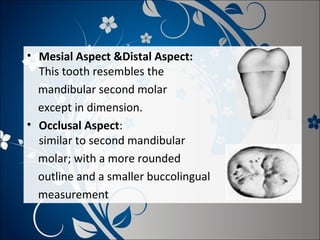• Mesial Aspect &Distal Aspect:
This tooth resembles the
mandibular second molar
except in dimension.
• Occlusal Aspect:
similar to second mandibular
molar; with a more rounded
outline and a smaller buccolingual
measurement

 
