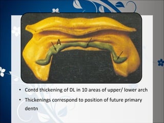 • Contd thickening of DL in 10 areas of upper/ lower arch
• Thickenings correspond to position of future primary
dentn

 