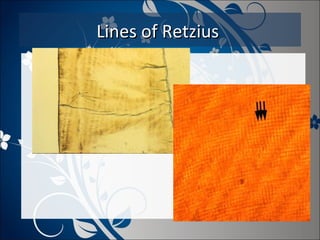 Lines of Retzius

 