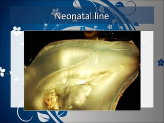 Neonatal line

 