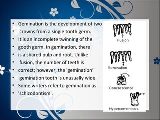 •
•
•
•
•
•
•
•
•
•

Gemination is the development of two
crowns from a single tooth germ.
It is an incomplete twinning of the
gooth germ. In gemination, there
is a shared pulp and root. Unlike
fusion, the number of teeth is
correct; however, the 'gemination‘
gemination tooth is unusually wide.
Some writers refer to gemination as
'schizodontism'.

 