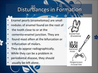 Disturbances in Formation
•
•
•
•
•
•
•
•
•
•

Enamel pearls (enamelomas) are small
nodules of enamel found on the root of
the tooth close to or at the
cemento-enamel junction. They are
found most often at the bifurcation or
trifurcation of molars.
They do appear radiographically.
While they can be a problem in
periodontal disease, they should
usually be left alone.

 