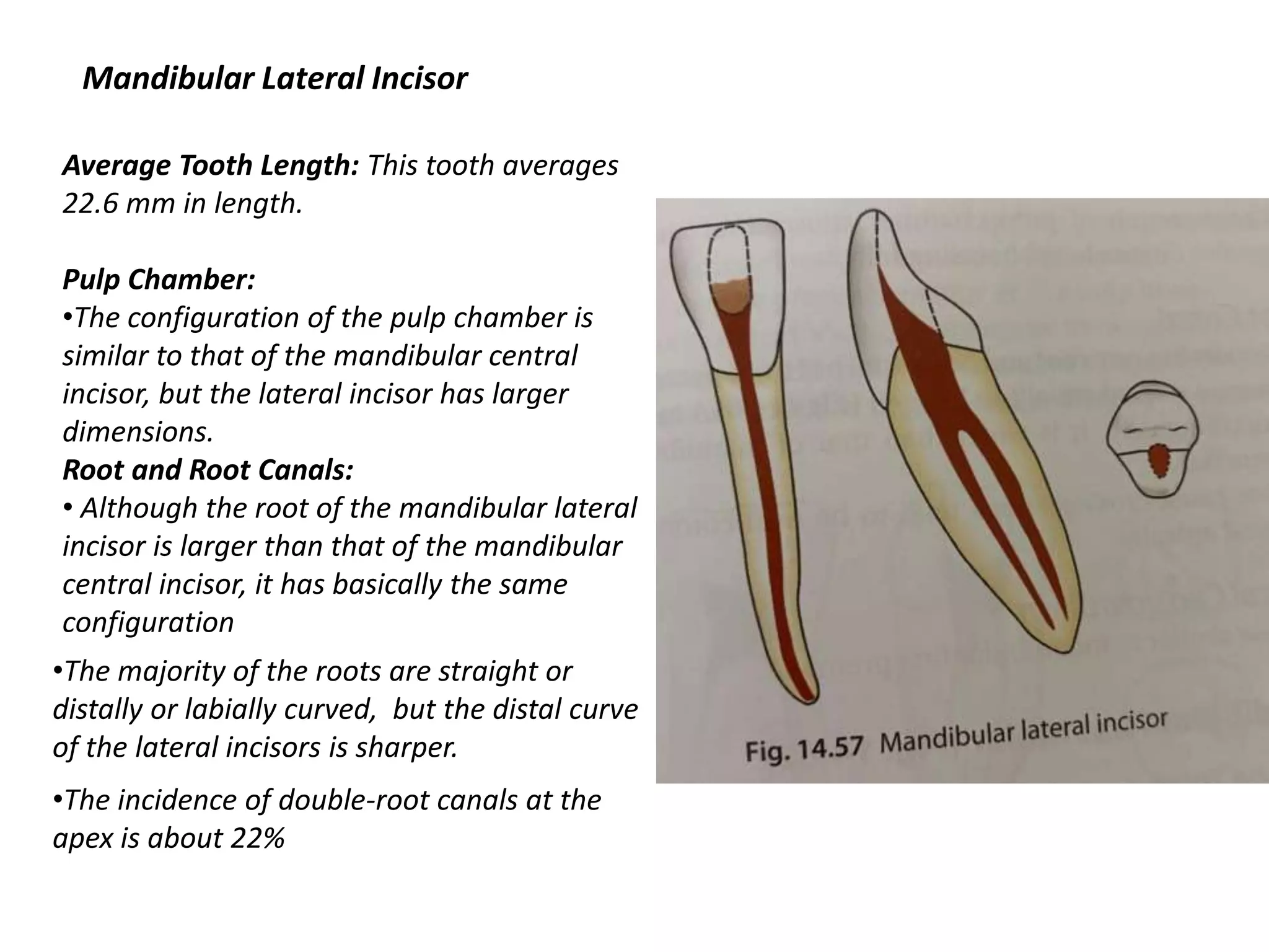 Average Tooth Length: This tooth averages
22.6 mm in length.
Pulp Chamber:
•The configuration of the pulp chamber is
similar to that of the mandibular central
incisor, but the lateral incisor has larger
dimensions.
Root and Root Canals:
• Although the root of the mandibular lateral
incisor is larger than that of the mandibular
central incisor, it has basically the same
configuration
Mandibular Lateral Incisor
•The majority of the roots are straight or
distally or labially curved, but the distal curve
of the lateral incisors is sharper.
•The incidence of double-root canals at the
apex is about 22%
 