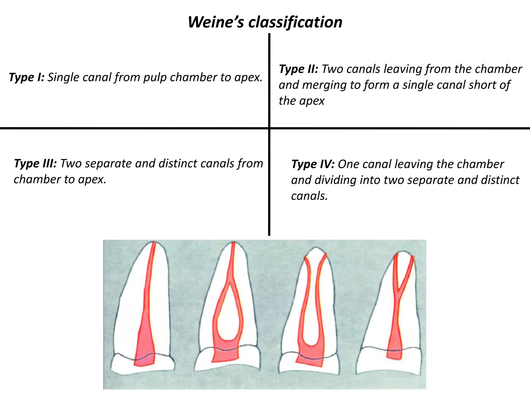 Type I: Single canal from pulp chamber to apex.
Type III: Two separate and distinct canals from
chamber to apex.
Weine’s classification
Type II: Two canals leaving from the chamber
and merging to form a single canal short of
the apex
Type IV: One canal leaving the chamber
and dividing into two separate and distinct
canals.
 