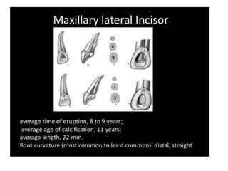Ledge Rct Morphology and internal anatomy of root canal system | PPTX
