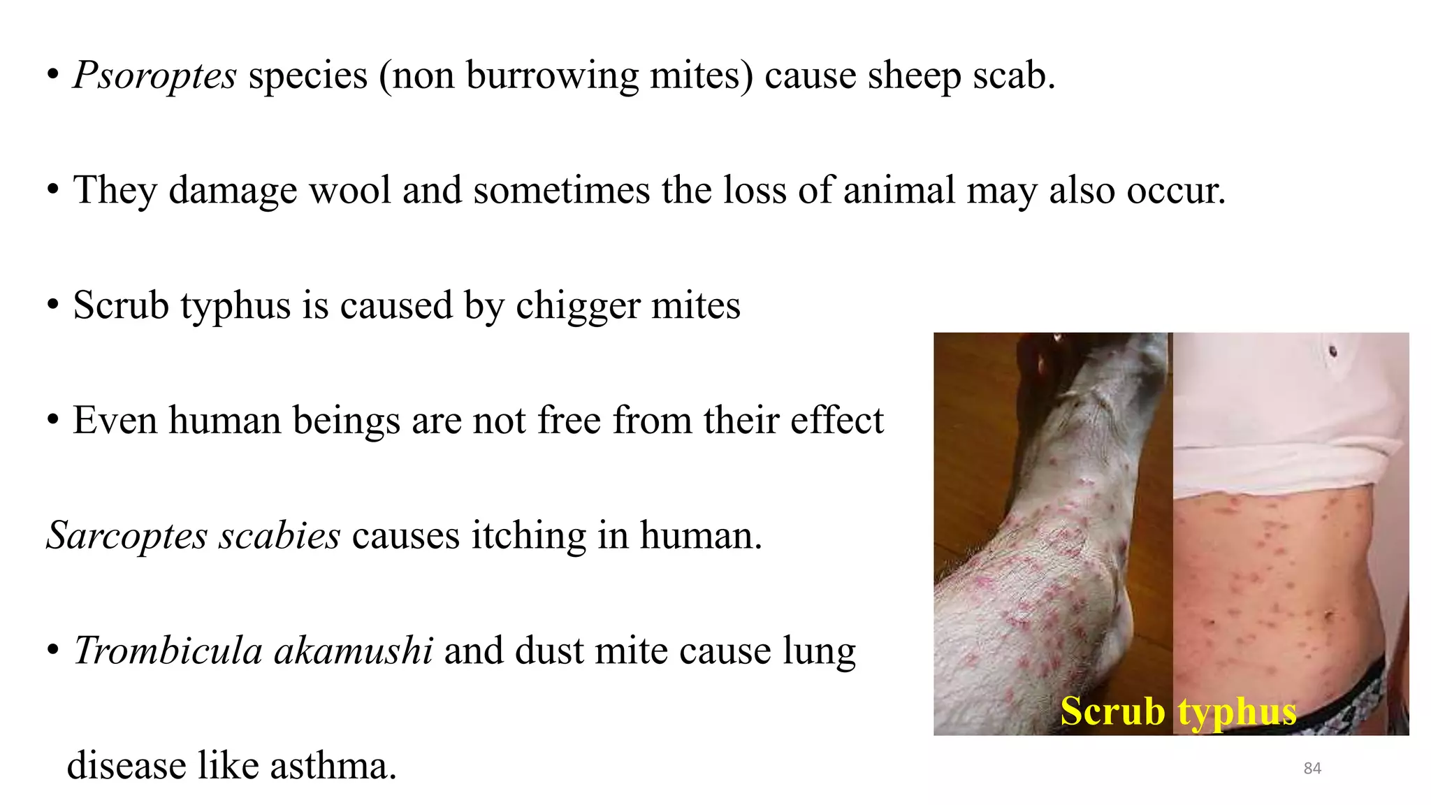 • Psoroptes species (non burrowing mites) cause sheep scab.
• They damage wool and sometimes the loss of animal may also occur.
• Scrub typhus is caused by chigger mites
• Even human beings are not free from their effect
Sarcoptes scabies causes itching in human.
• Trombicula akamushi and dust mite cause lung
disease like asthma. 84
Scrub typhus
 