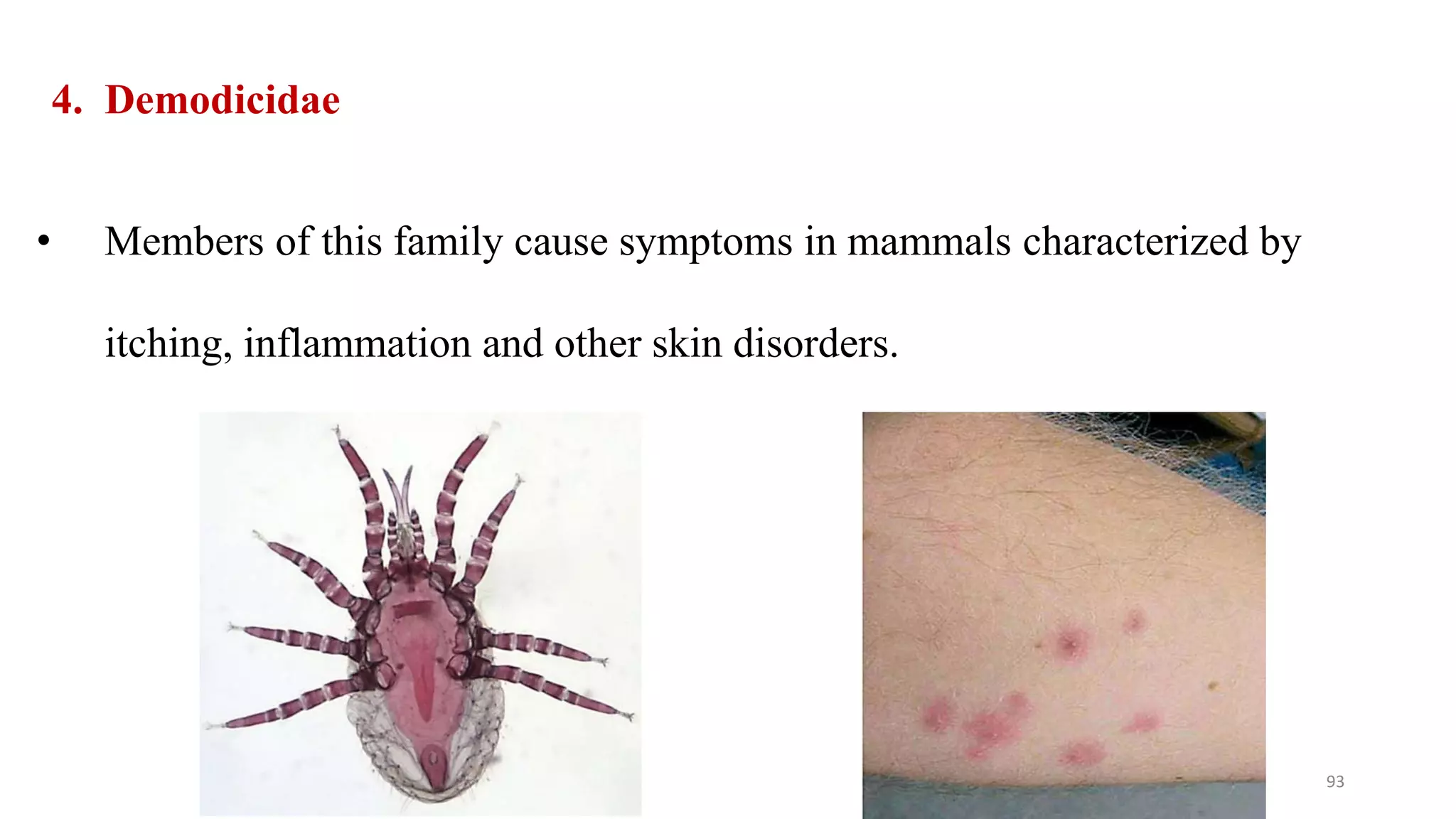 4. Demodicidae
• Members of this family cause symptoms in mammals characterized by
itching, inflammation and other skin disorders.
93
 