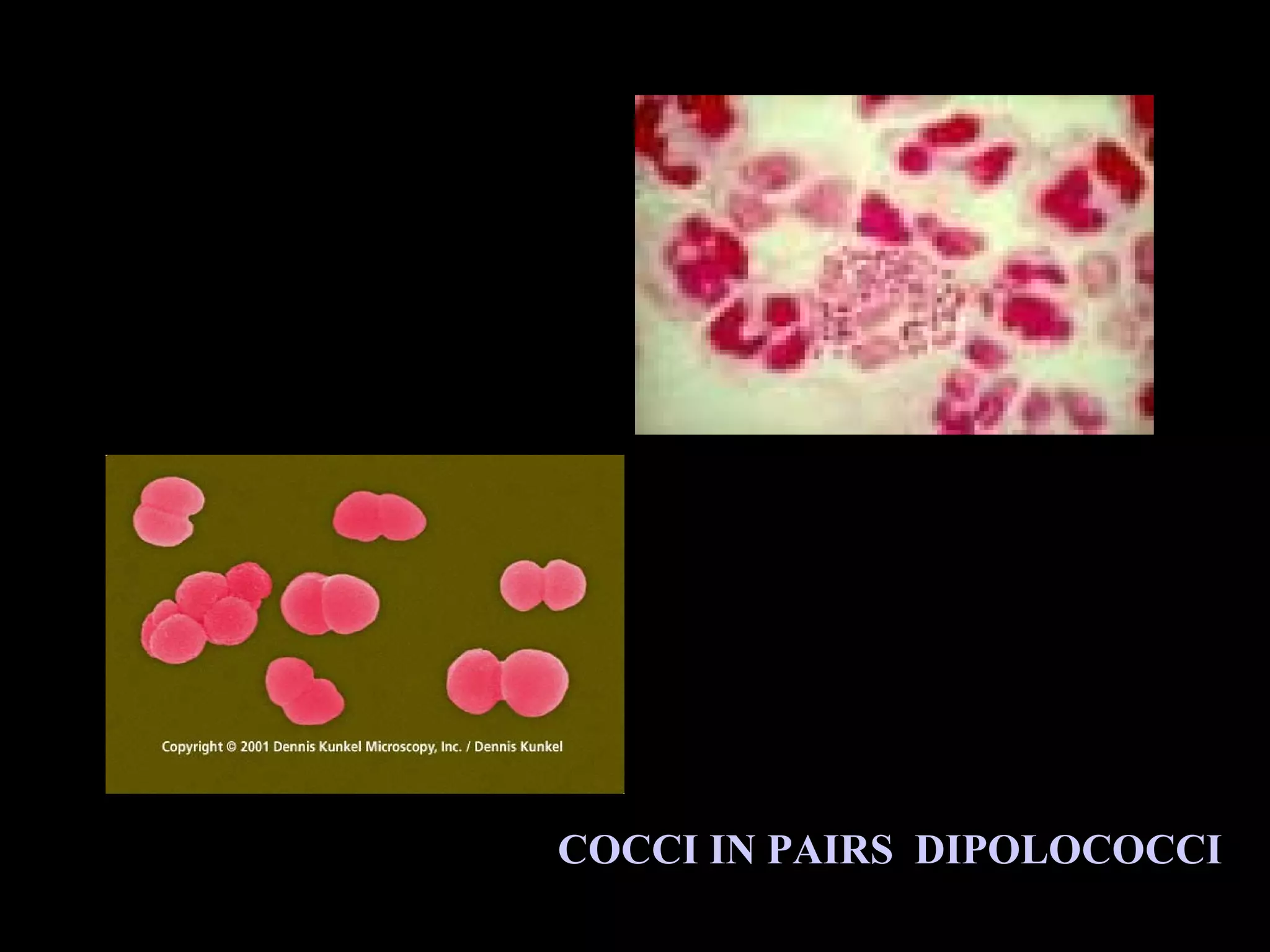 COCCI IN PAIRS DIPOLOCOCCI