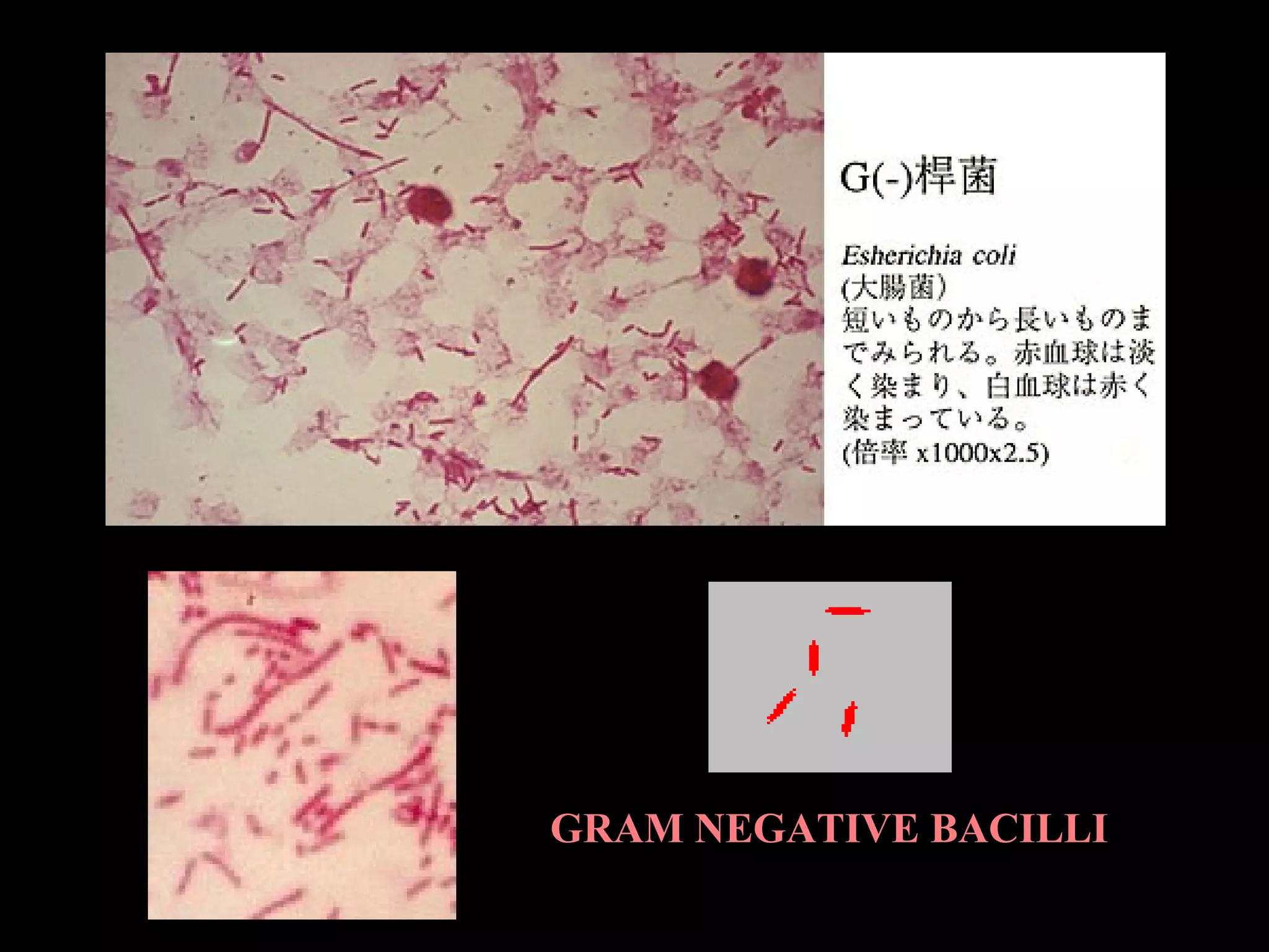 GRAM NEGATIVE BACILLI