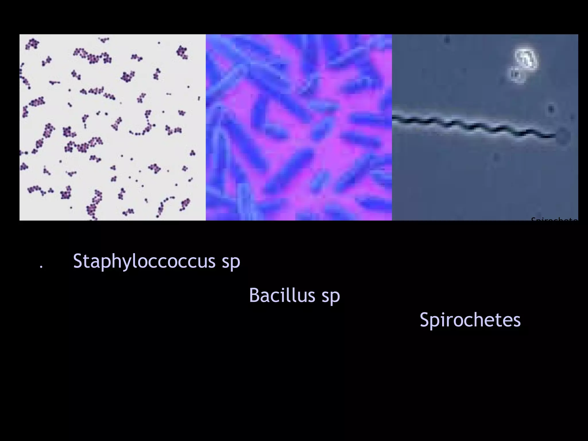 Spirochetes
. Staphyloccoccus sp
Bacillus sp
Spirochetes