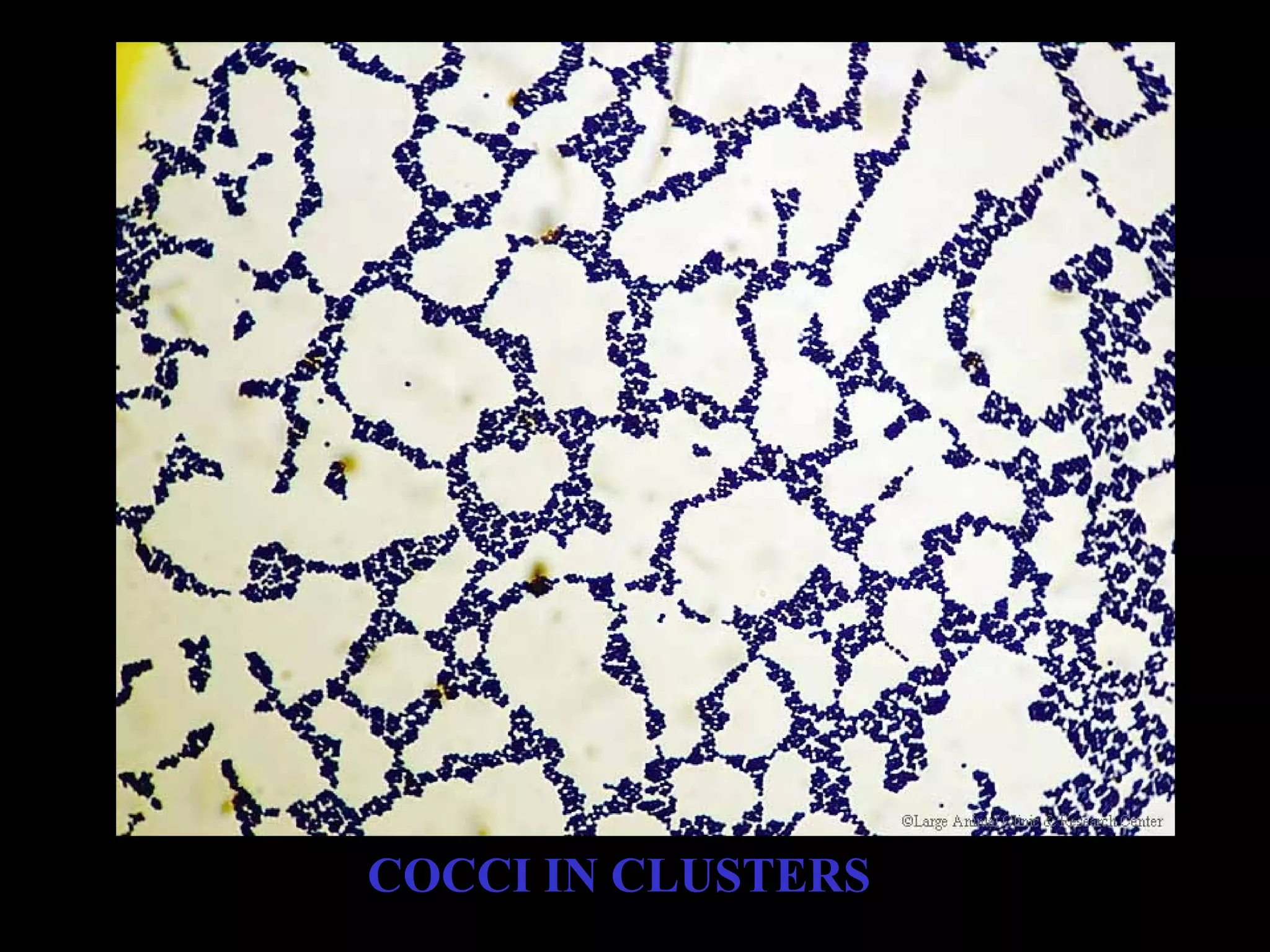 COCCI IN CLUSTERS