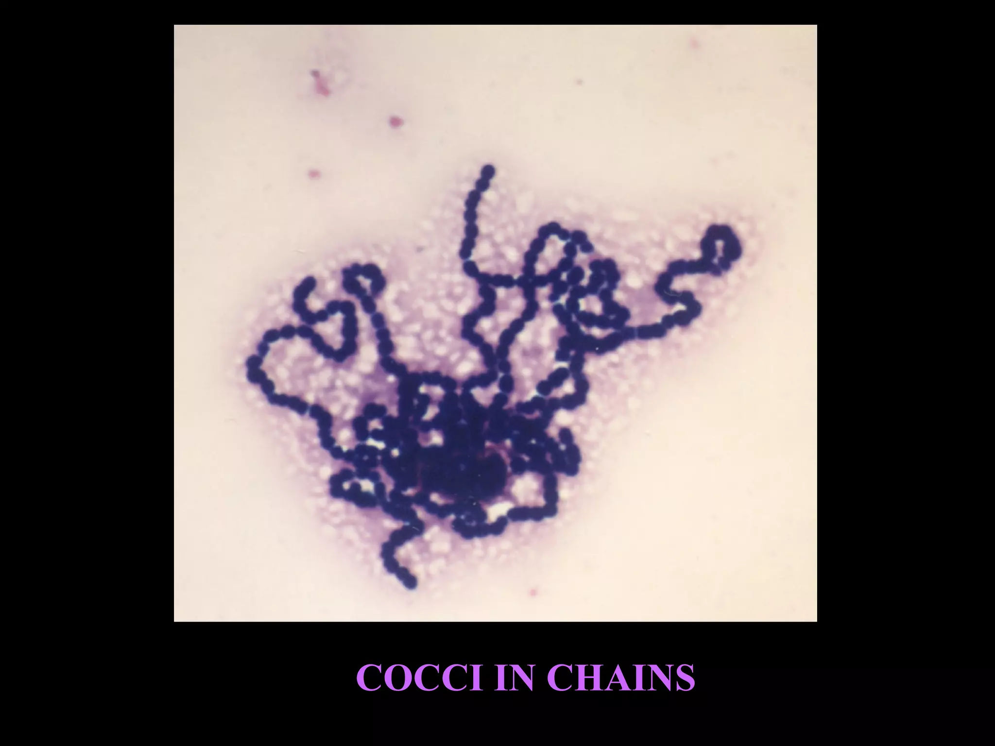 COCCI IN CHAINS