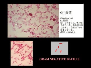 GRAM NEGATIVE BACILLI
 