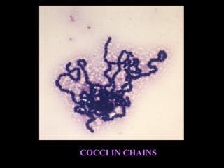 COCCI IN CHAINS
 